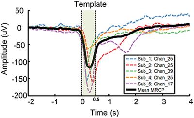 Electrocorticographic Temporal Alteration Mapping: A Clinical Technique for Mapping the Motor Cortex with Movement-Related Cortical Potentials